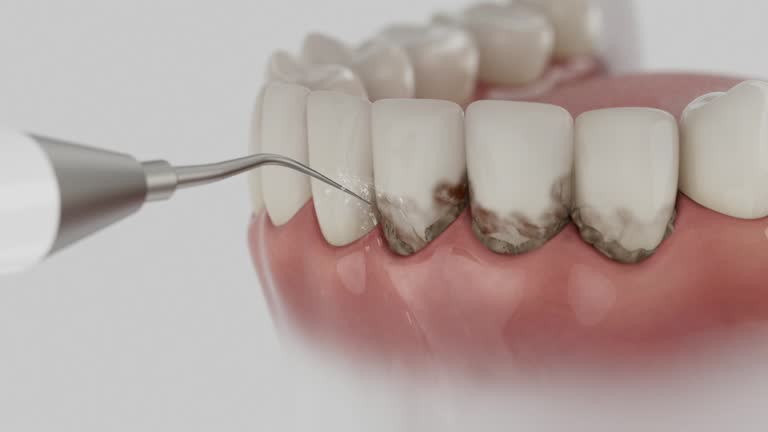 Trusted Dental Crowns And Bridges service in Decatur, MS - Dentist Open Now